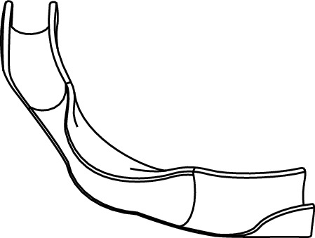 TECE 77910012 TECEfloor Фиксатор поворота трубы, 25